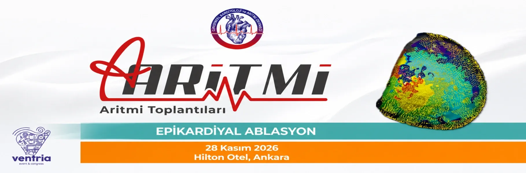 Epikardiyal Ablasyon